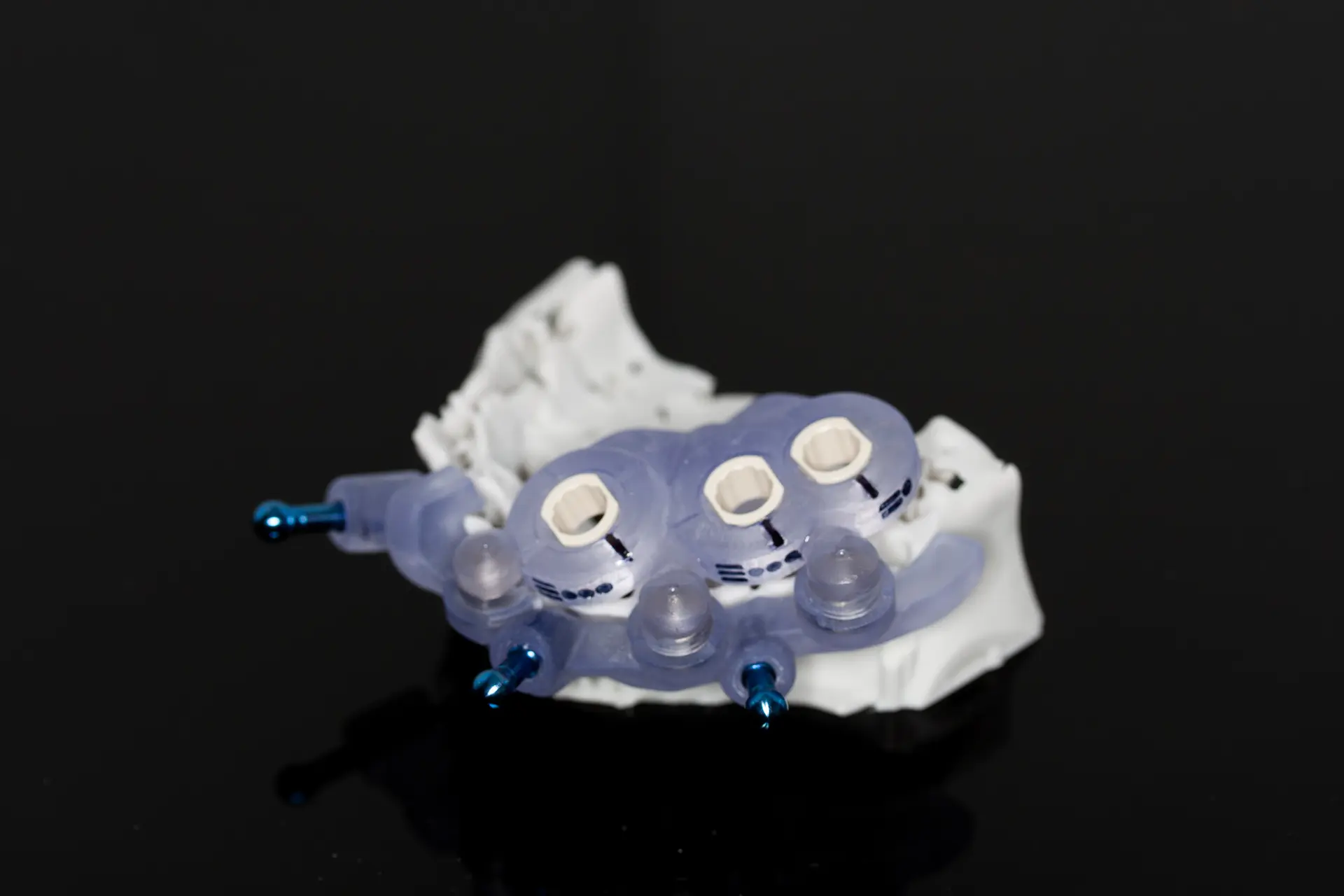 Dental CAD Design Quality Checklist
